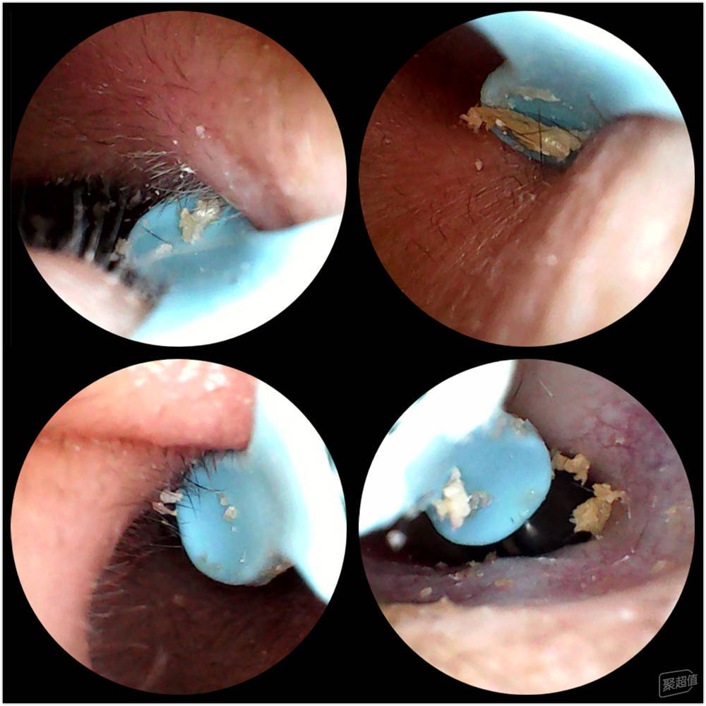 西圣Find智能可视挖耳勺:告别传统开启耳朵清洁新时代!(图13)