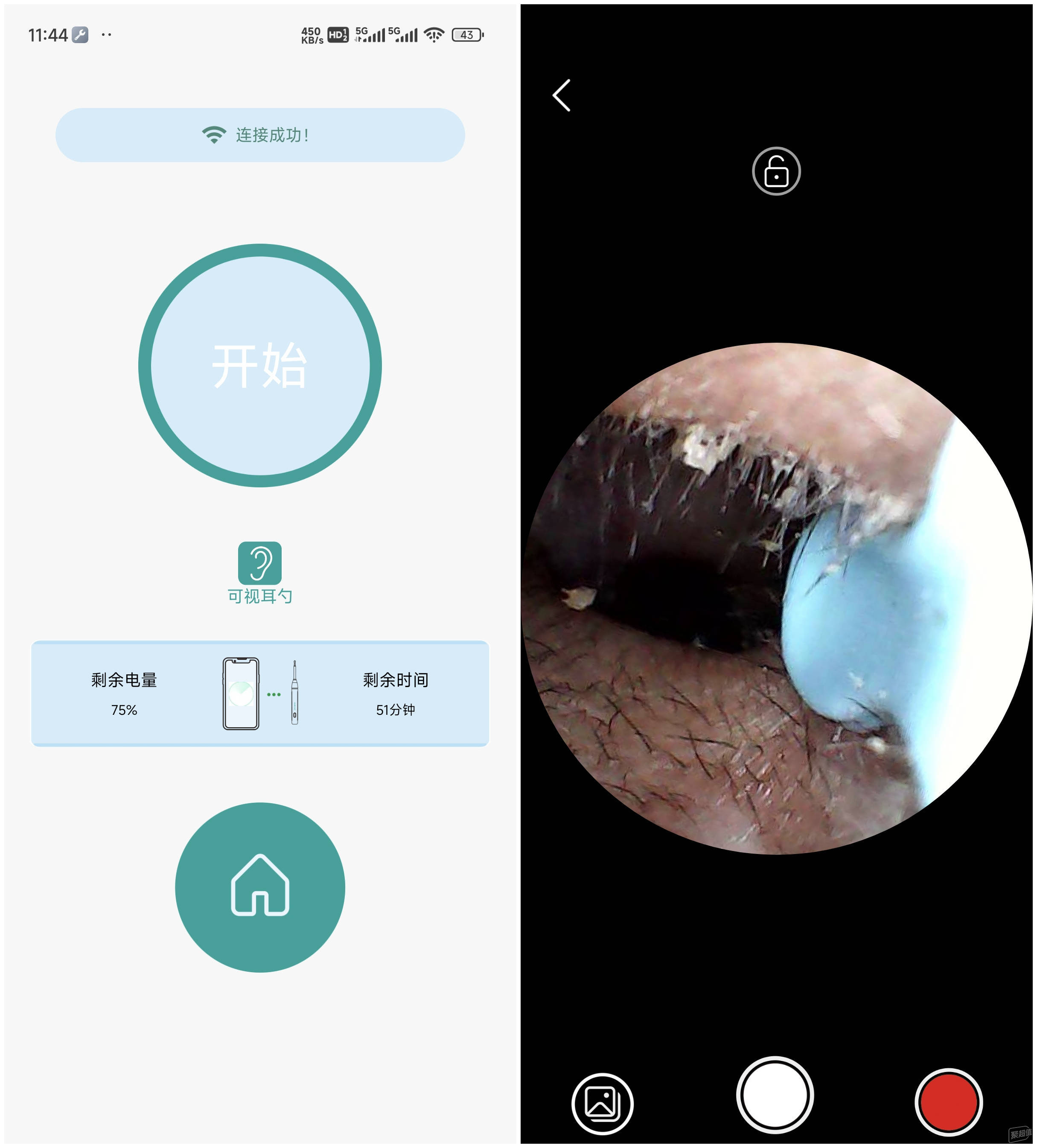 西圣Find智能可视挖耳勺:告别传统开启耳朵清洁新时代!(图15)