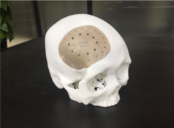 专业的PEEK3d打印机加工服务排行(图2)